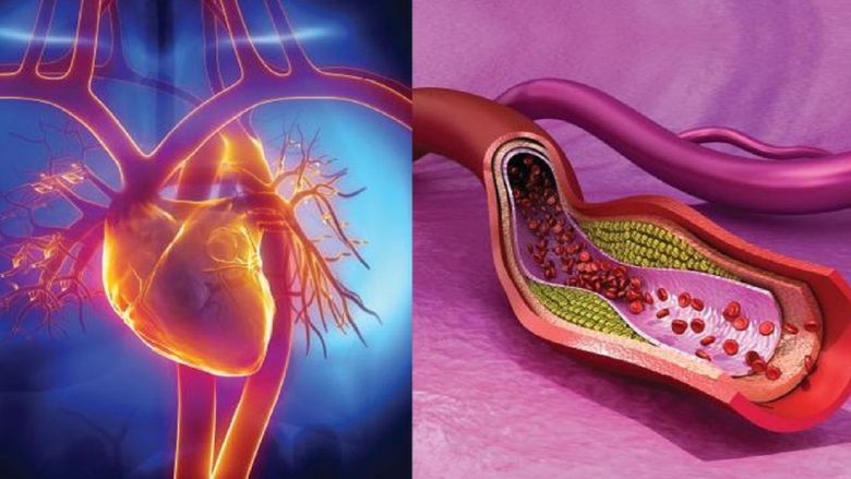 These five things work as nectar to increase good cholesterol